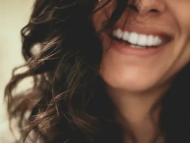 Porcelain Veneer (per gigi)