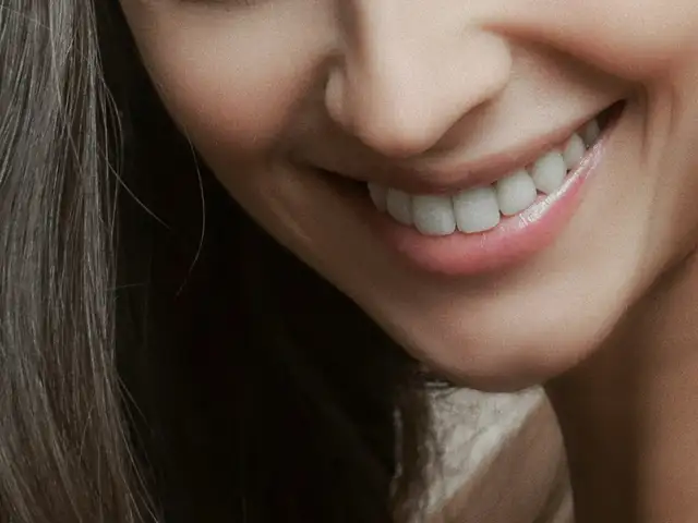 Smile Makeover Package (8 gigi)
