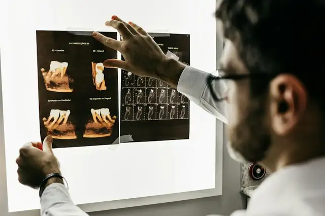 Kapan Anak Harus Pertama Kali ke Dokter Gigi?