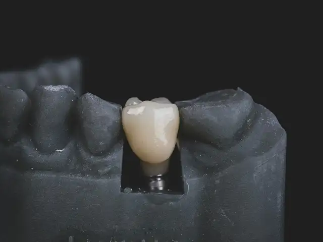 Crown Zirconia