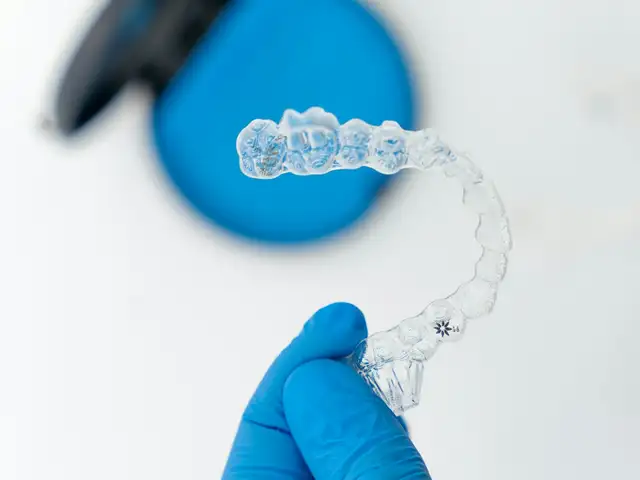 Retainer (setelah behel)